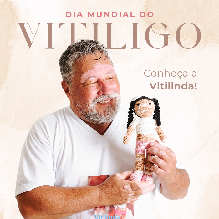 Dia Mundial do Vitiligo: celebre com a beleza dos amigurumis!